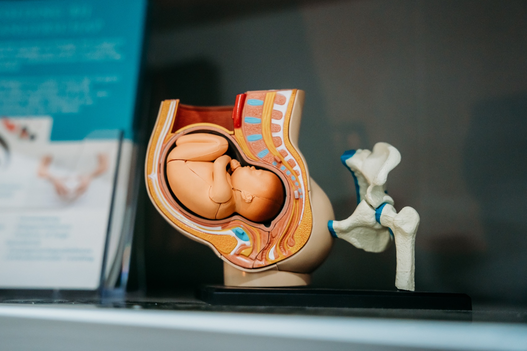 Anatomisch model van een baby in het bekken bij Femme Verloskundigen Den Haag